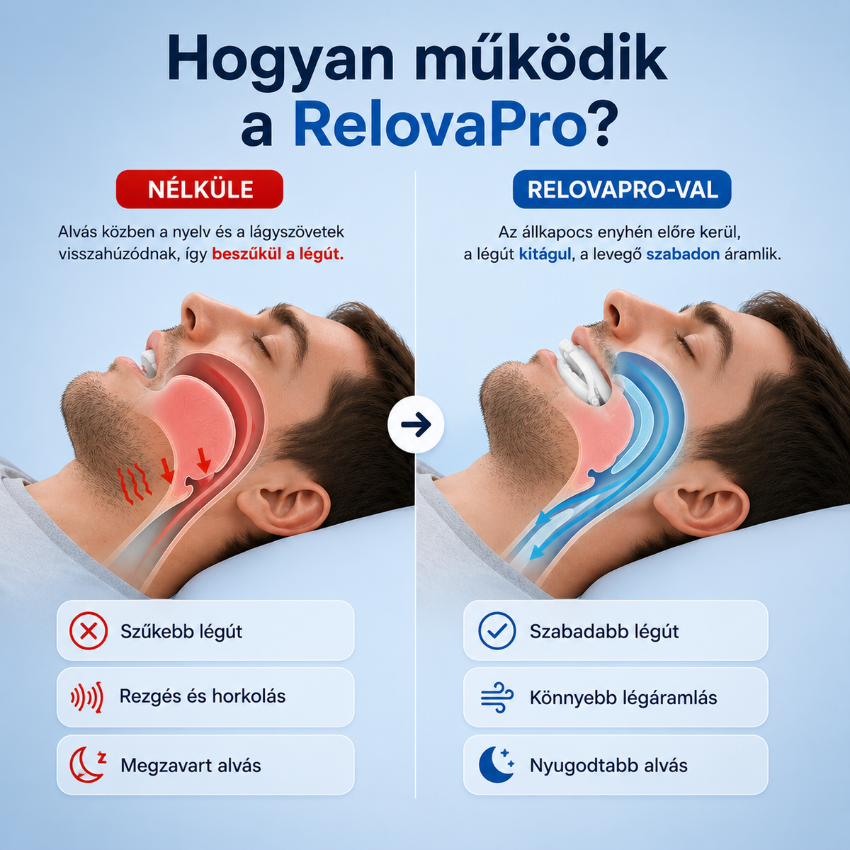 RelovaPro – Horkoláscsökkentő szájbetét